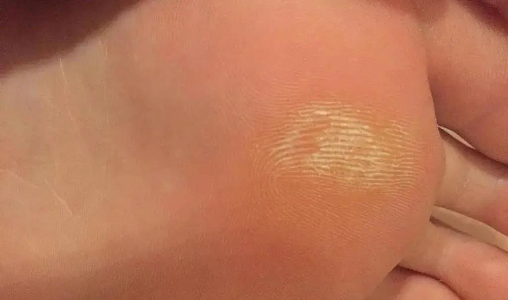 修腳加盟 修腳加盟